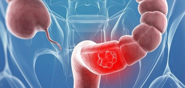 Una alimentación saludable previene los trastornos digestivos en los mayores de 60 años