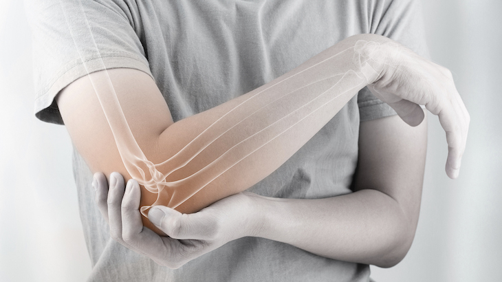 Fragilidad ósea tras el confinamiento