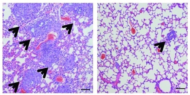 Muchos tumores malignos podrían evitarse adoptando hábitos de vida saludables como la Dieta Mediterranea