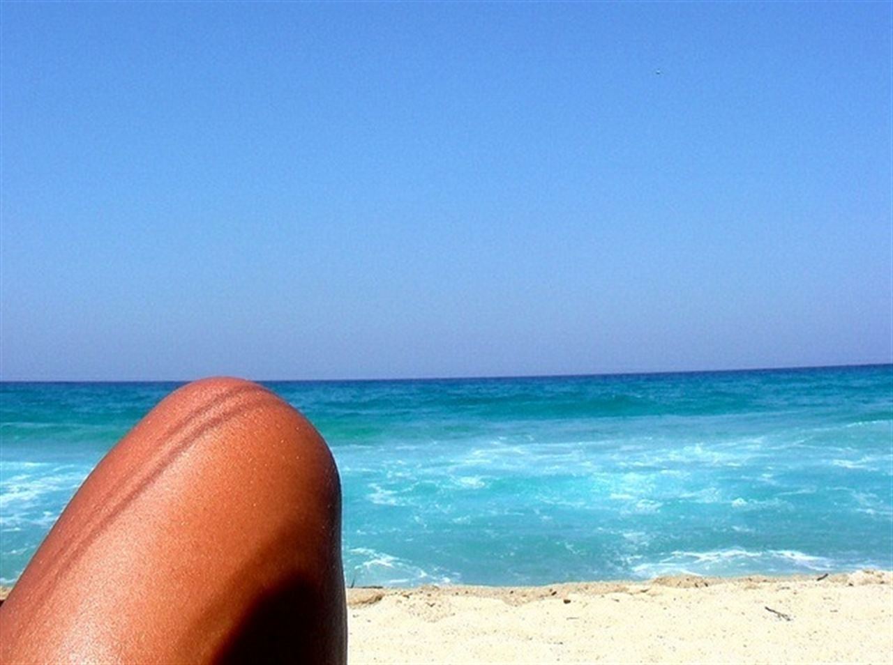 El cáncer de piel afectará a un 20% de españoles