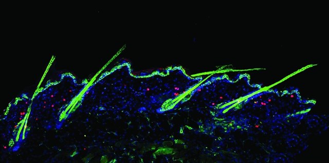 Descubren un nuevo mecanismo de crecimiento del cabello