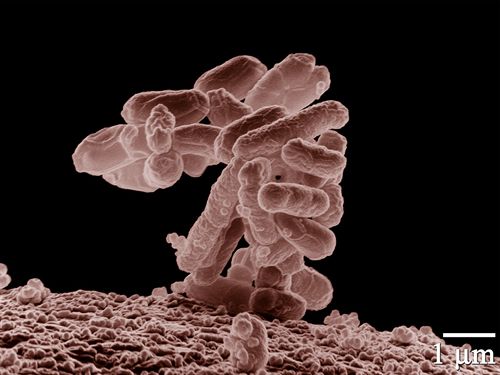 Descubren un conservante natural que acaba con bacterias como la salmonela o la E.coli
