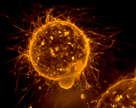 Las grasas como los aceites de palma o de coco presentes en las comidas procesadas propagan el cáncer