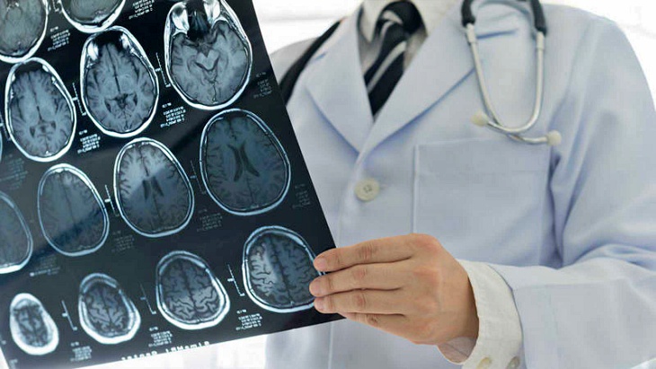 En el ‘Día Mundial del Ictus’ te contamos como una dieta saludable te puede ayudar a prevenirlo