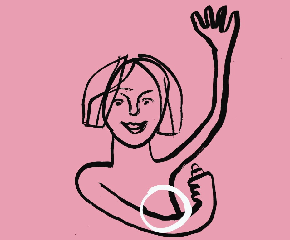 Veritas cáncer mama