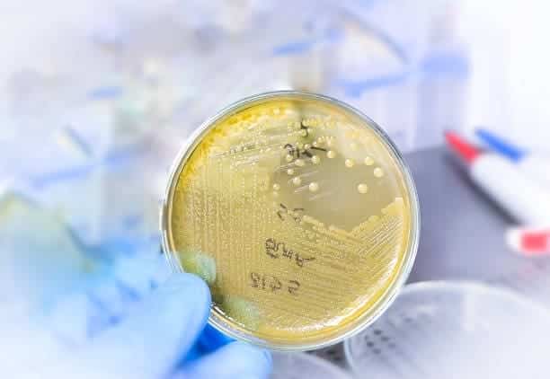 hongo microscópico peligroso salud pública origen calentamiento global cambio climático