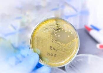 hongo microscópico peligroso salud pública origen calentamiento global cambio climático
