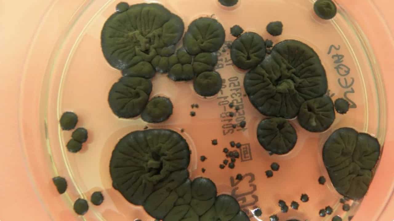 Una muestra de 'Cladosporium sphaerospermum' (Atlas of Mycology/Rui Tomé)