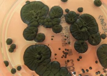 Científicos analizan los hongos negros de Chernóbil y descubren que guardan el secreto para hacer posibles los viajes espaciales 2 Una muestra de 'Cladosporium sphaerospermum' (Atlas of Mycology/Rui Tomé)