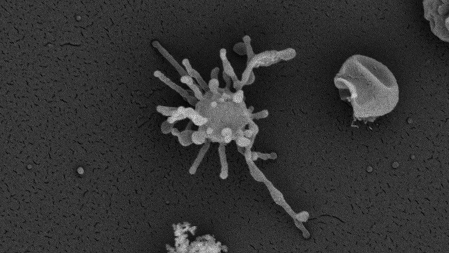 Microorganismo del grupo Asgard, posible ancestro común de animales, plantas y hongos.