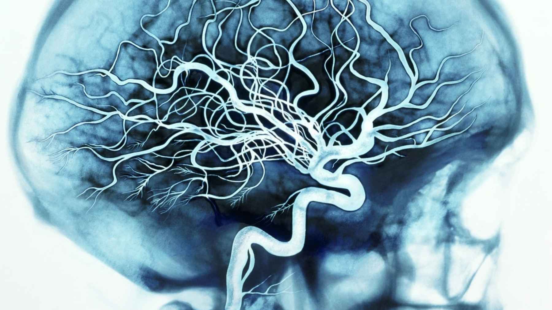 Imagen de resonancia del cerebro con una red neuronal que ilustra el sistema de navegación y orientación espacial