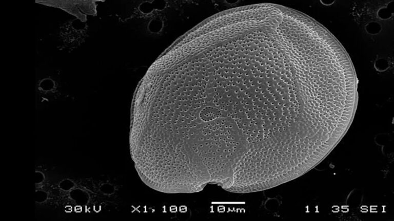 Análisis de microalga tóxica detectada en el Mediterráneo peninsular