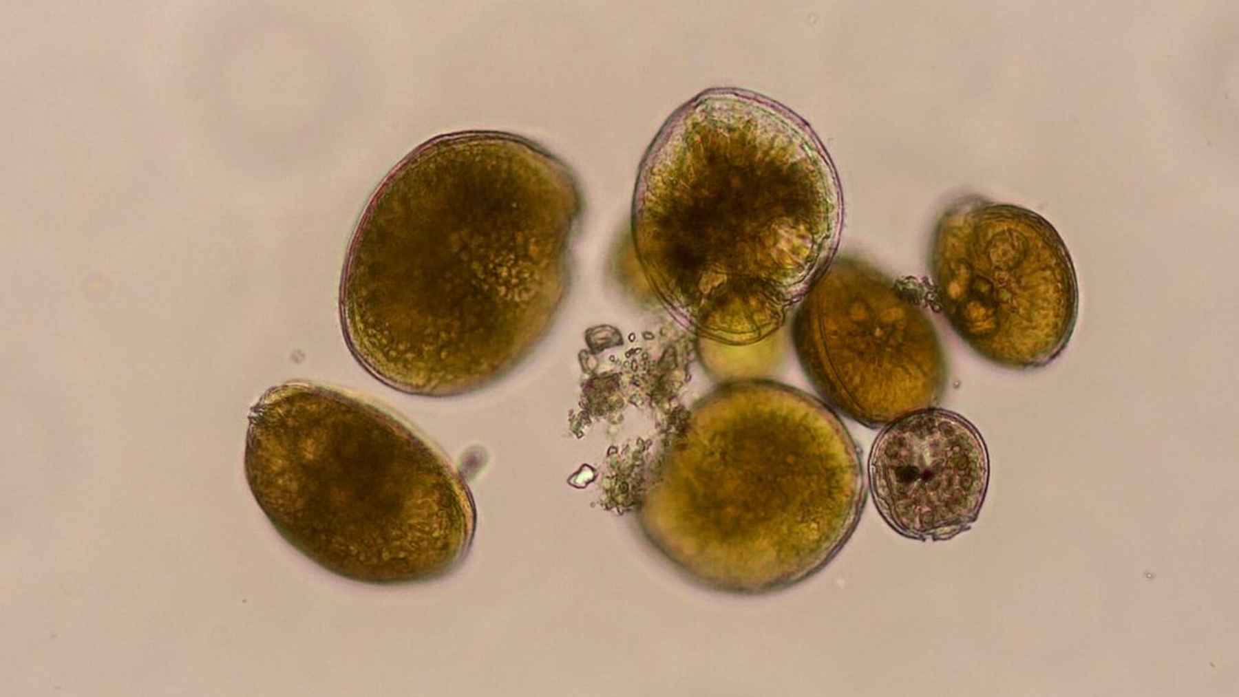 Microalga Gambierdiscus australes al microscopio detectada en el Mediterráneo peninsular