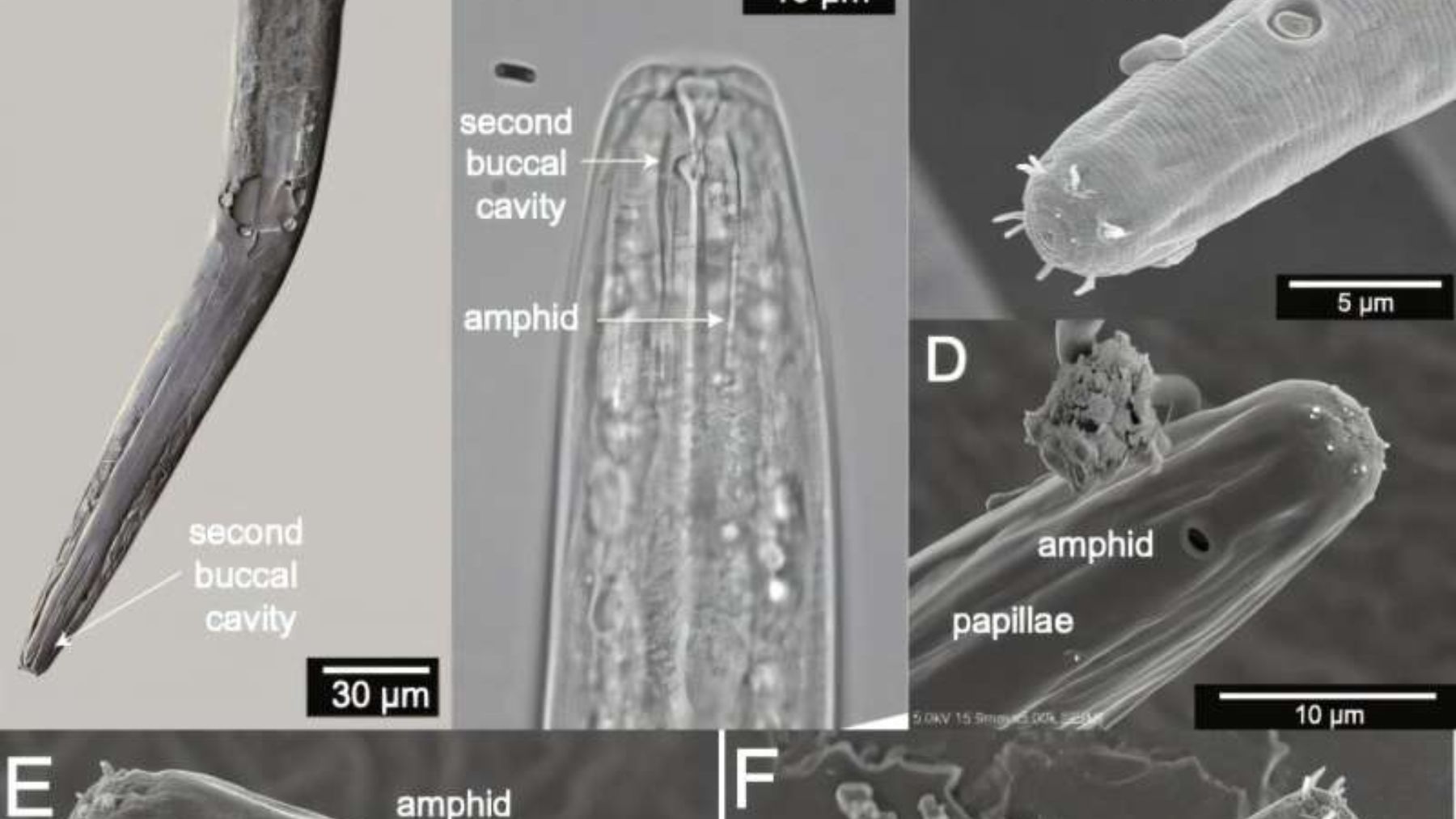 Imagen microscópica del nematodo Diplolaimelloides woaabi hallado en el Gran Lago Salado de Utah.