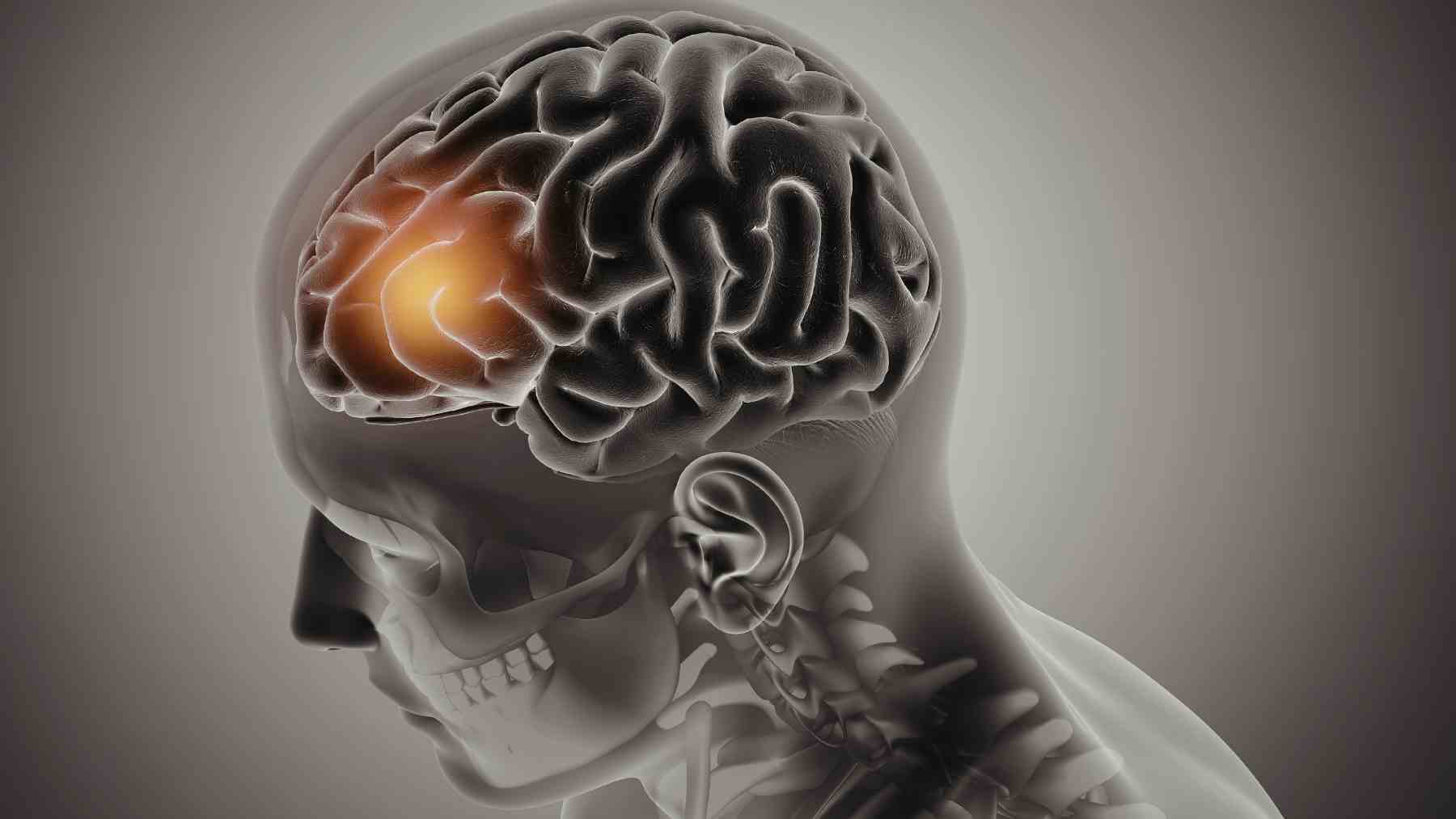 Ilustración del área de Broca en el cerebro humano relacionada con el lenguaje y el habla.