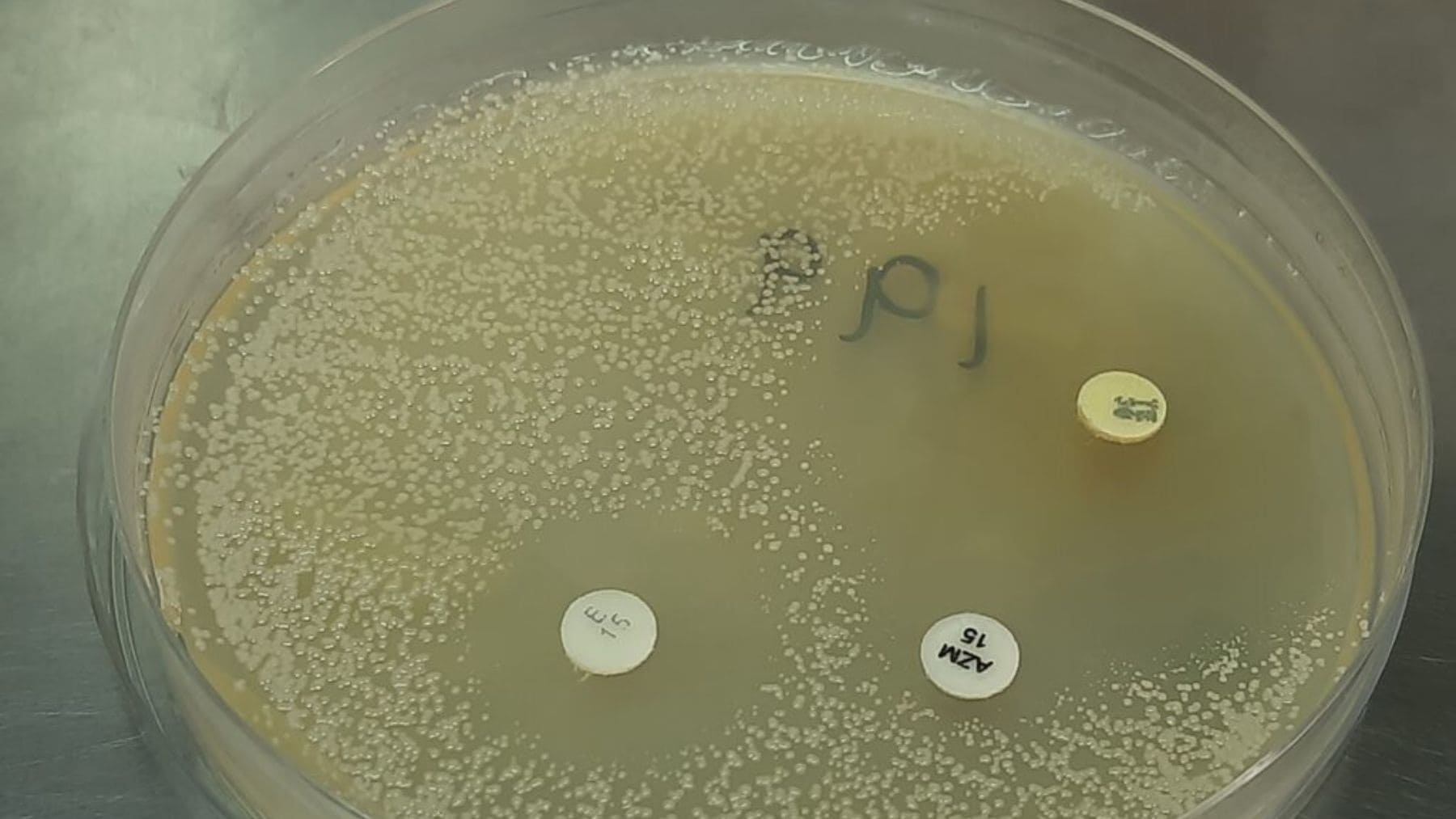 Cultivo bacteriano en laboratorio de Leuconostoc mesenteroides, microorganismo del kimchi estudiado por eliminar microplásticos.