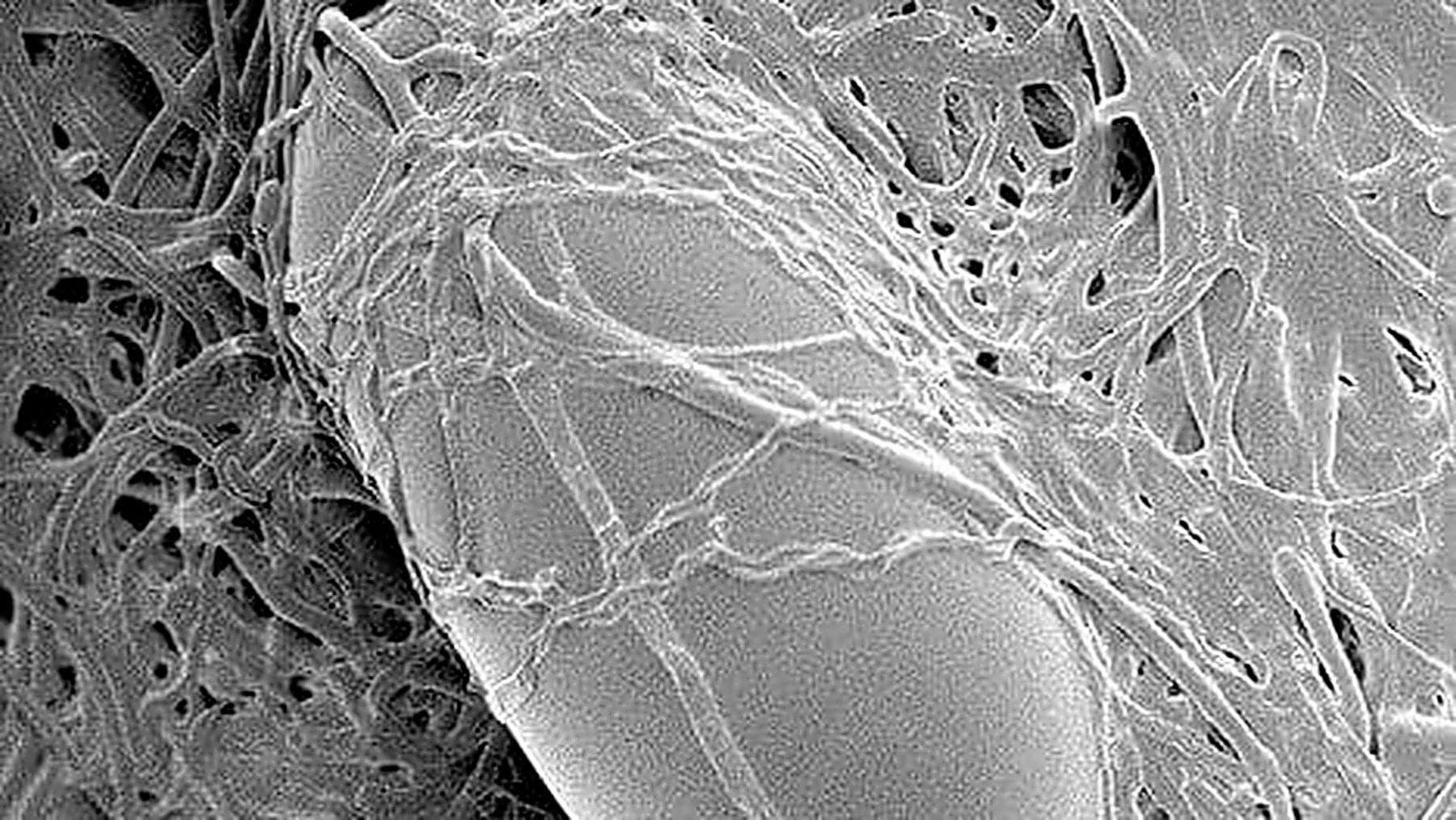 Hongo Pochonia chlamydosporia atacando un huevo de nematodo en un cultivo agrícola