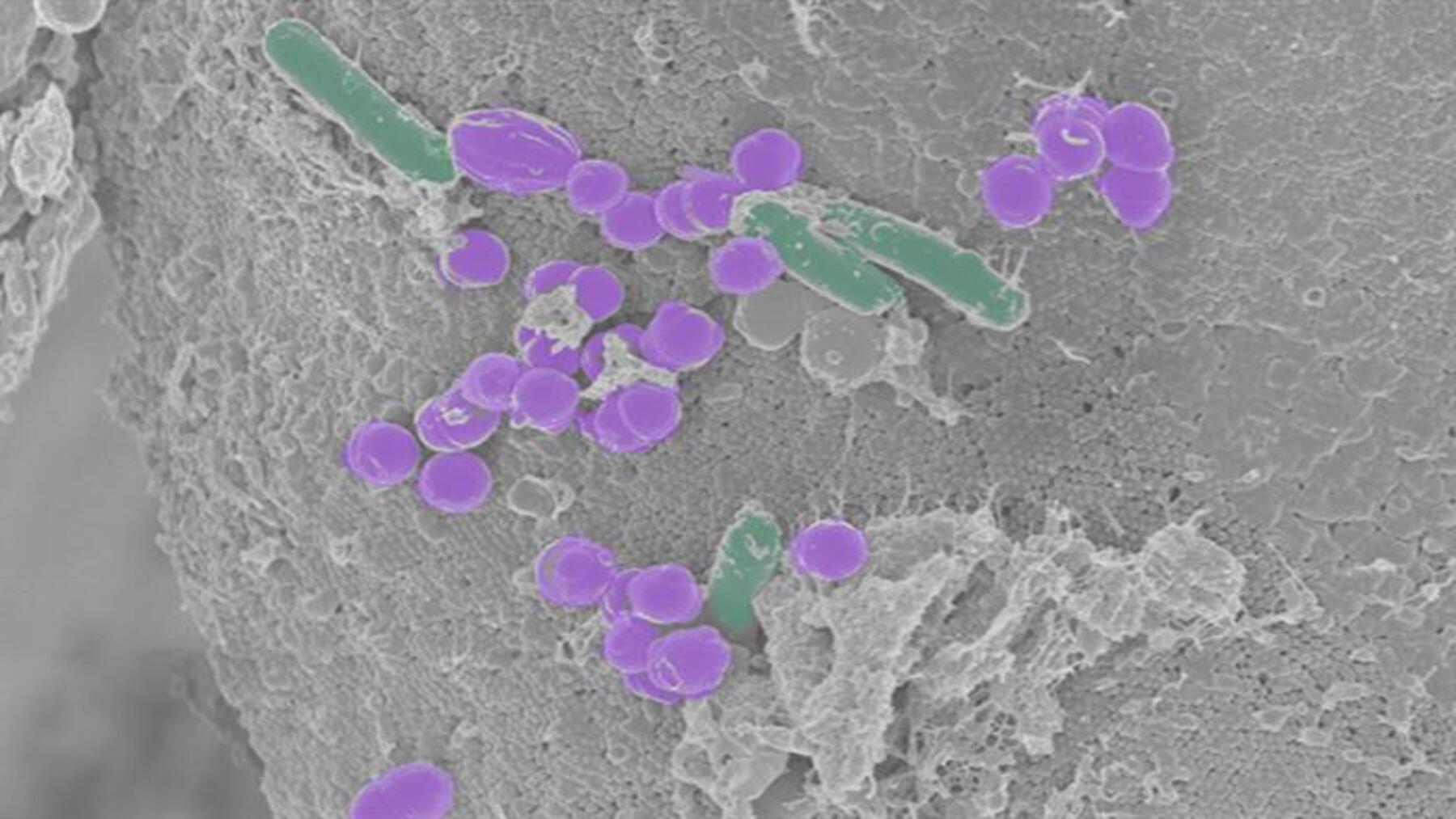 Crean una célula sintética capaz de crecer y reproducirse sin estar viva