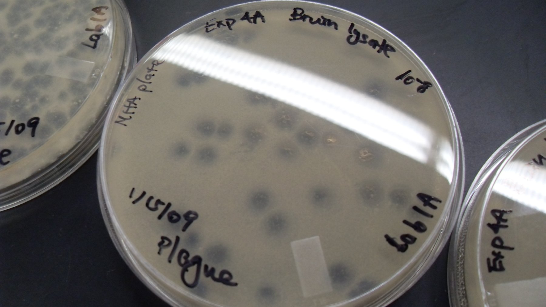 Placas de Petri con cultivos de la bacteria Mycobacterium smegmatis