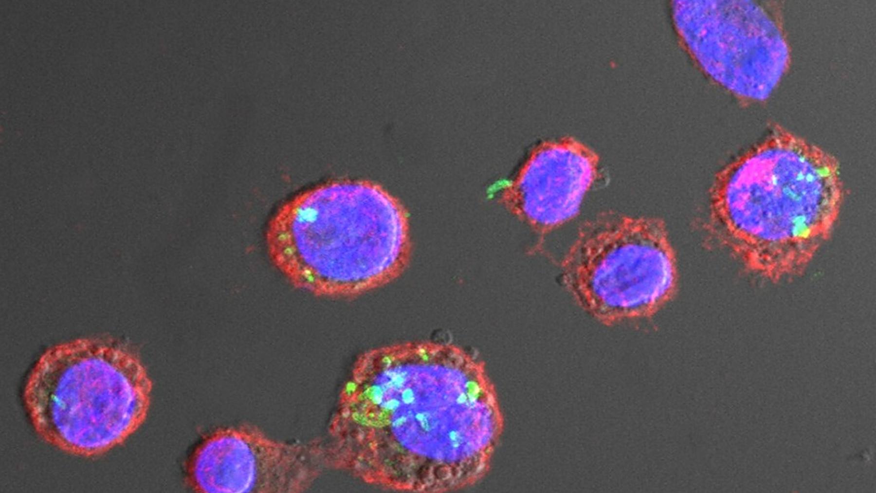 Bacteria Legionella en verde dentro de macrófagos, células del sistema inmunitario, vista al microscopio